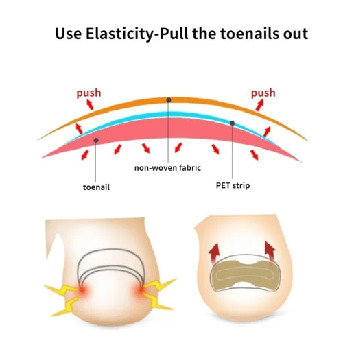 Αυτοκόλλητα Επιθέματα διόρθωσης νυχιών 
