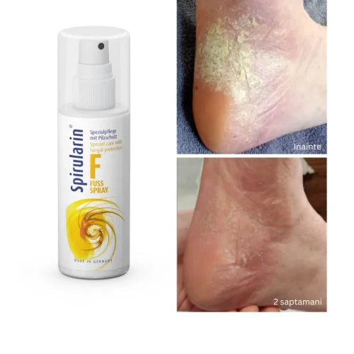 Spirularin F spray 100ml