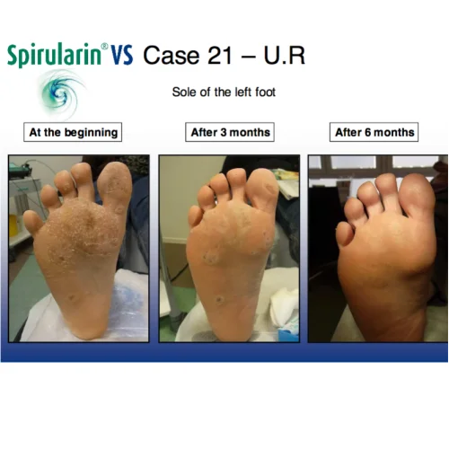 Spirularin® Κρέμα VS 10ml.